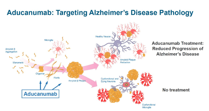 Aducanumab alzheimer antibody