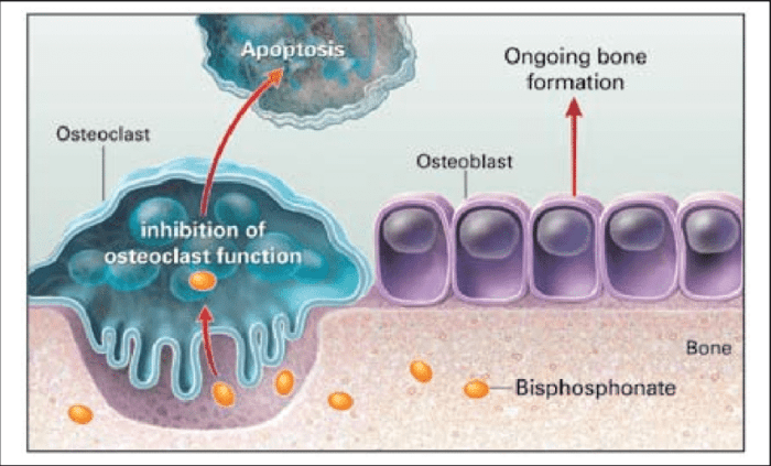 Bisphosphonates