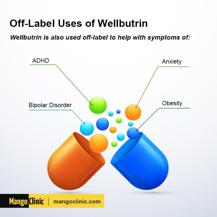 Wellbutrin for anxiety