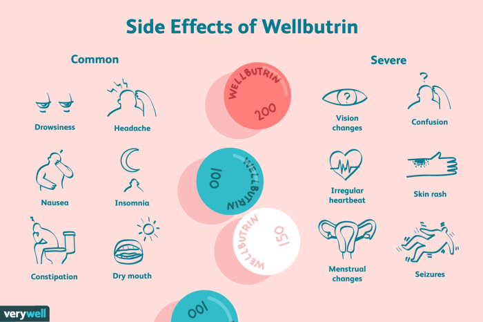 Wellbutrin for anxiety